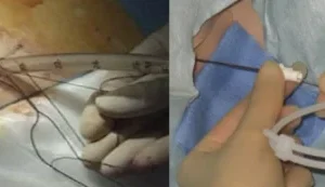Chest Drains Course (Stand-alone)
